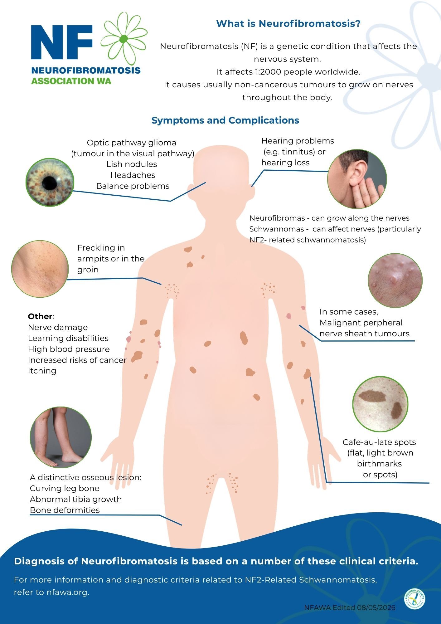 Neurofibromatosis Fact Sheet - NFAWA